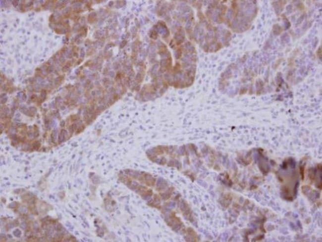 Anti-GTPBP9