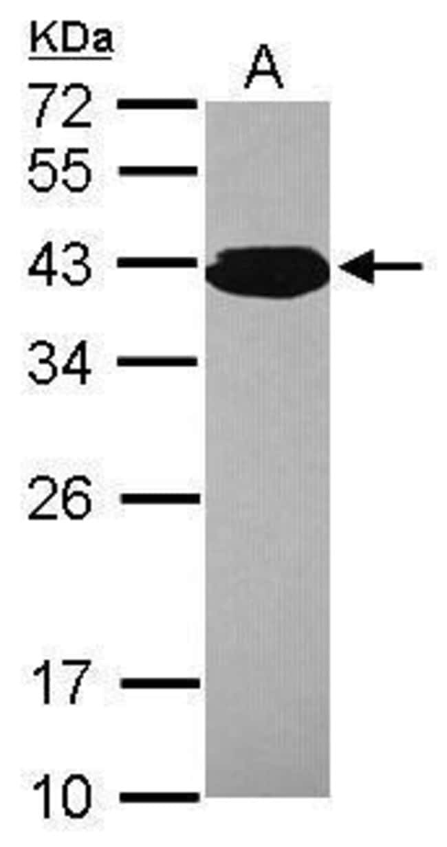 Anti-PCBP3
