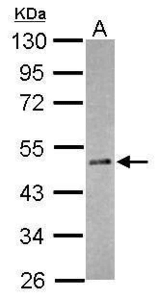 Anti-RBM41