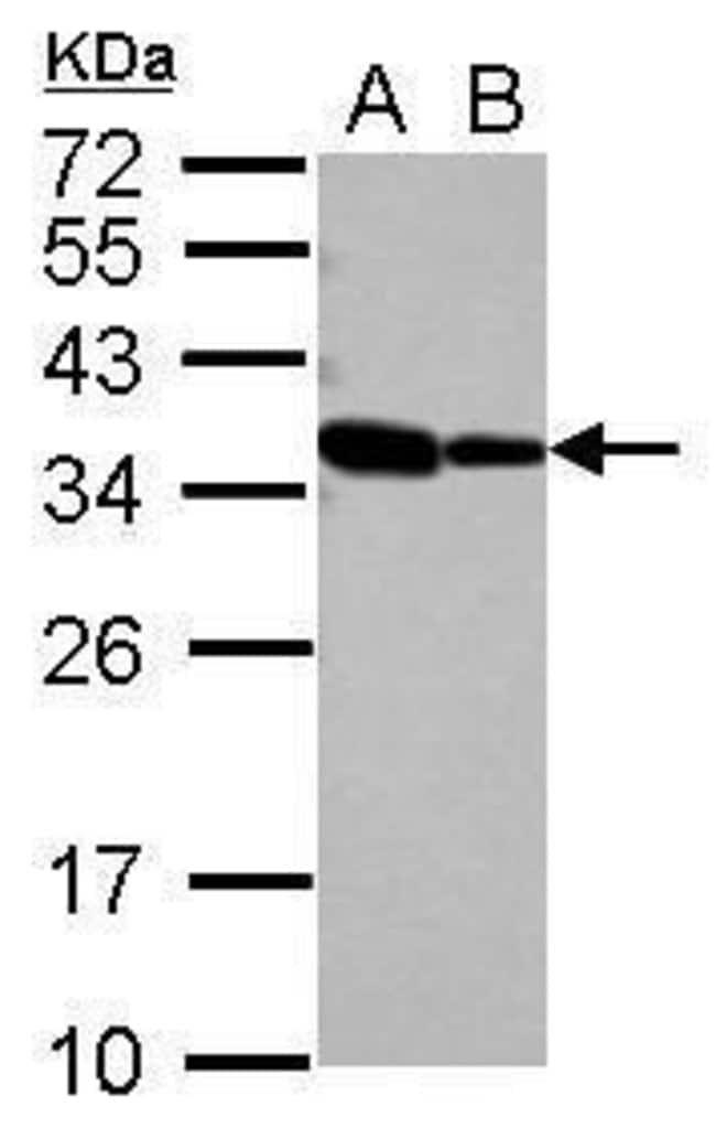 Anti-RBM11