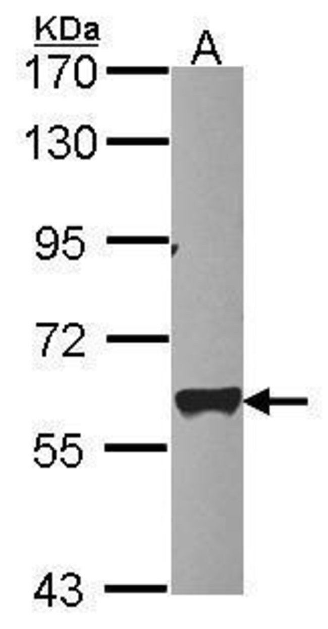 Anti-Mt PAP