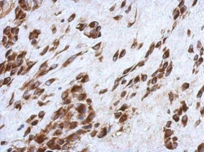 Anti-CCDC44