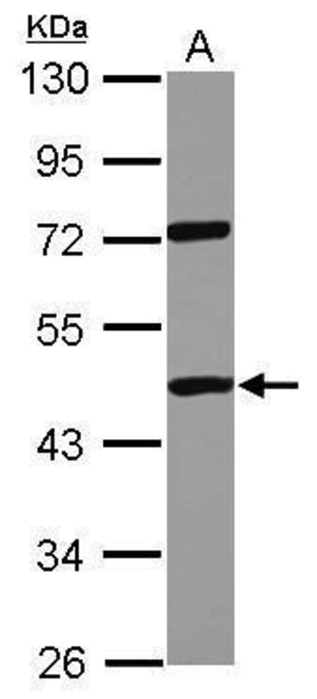 Anti-DDX19A