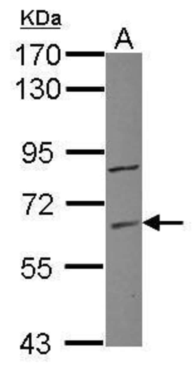 Anti-ZNF282