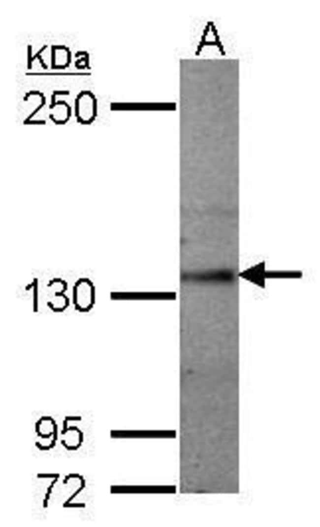 Anti-Semaphorin 5A