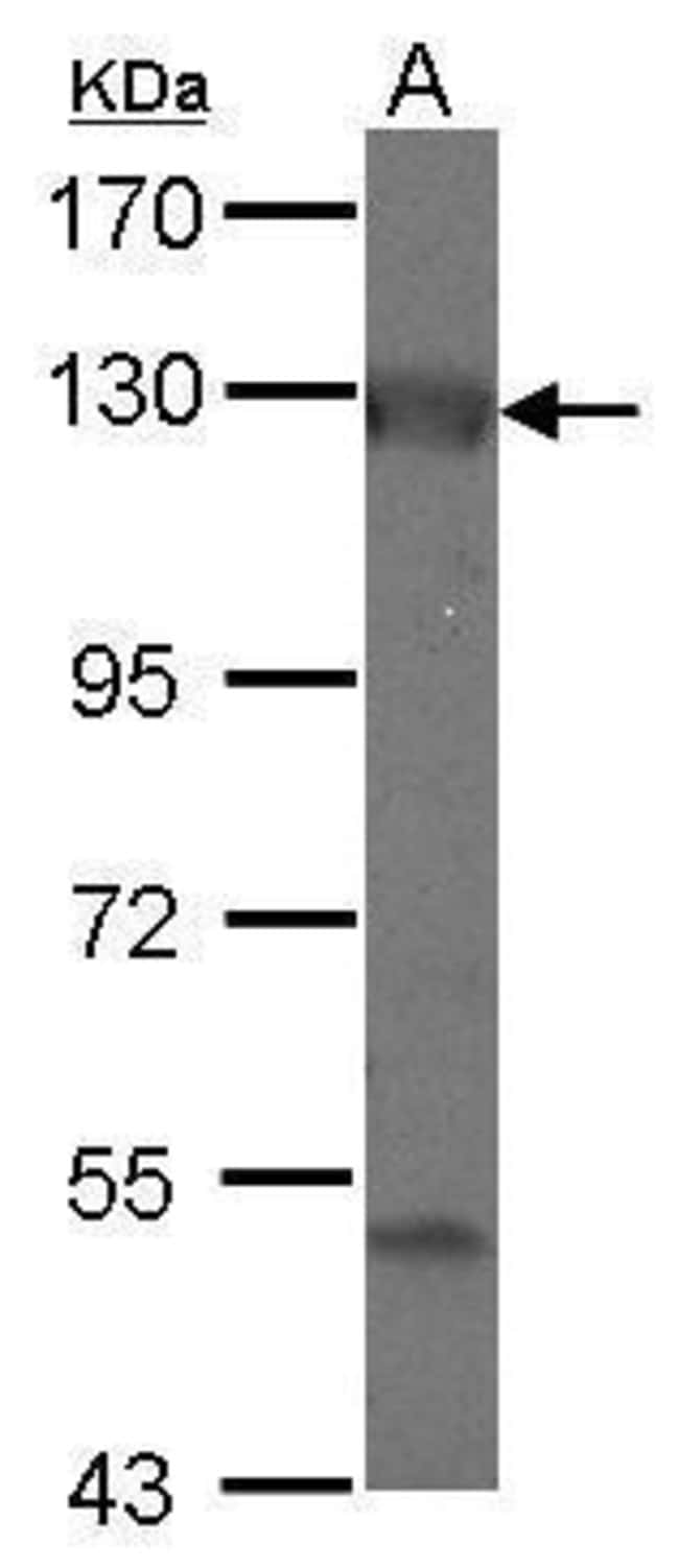 Anti-Adenylate cyclase 2