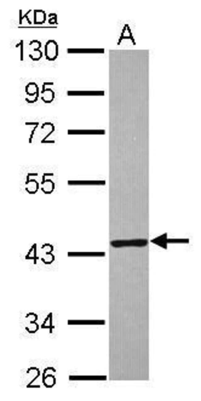 Anti-TXNL2