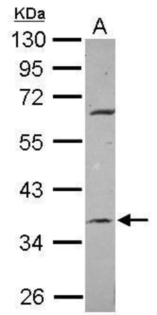 Anti-METTL2B