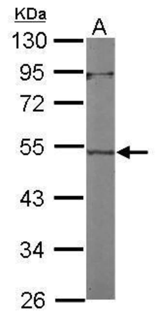 Anti-ACTL7A