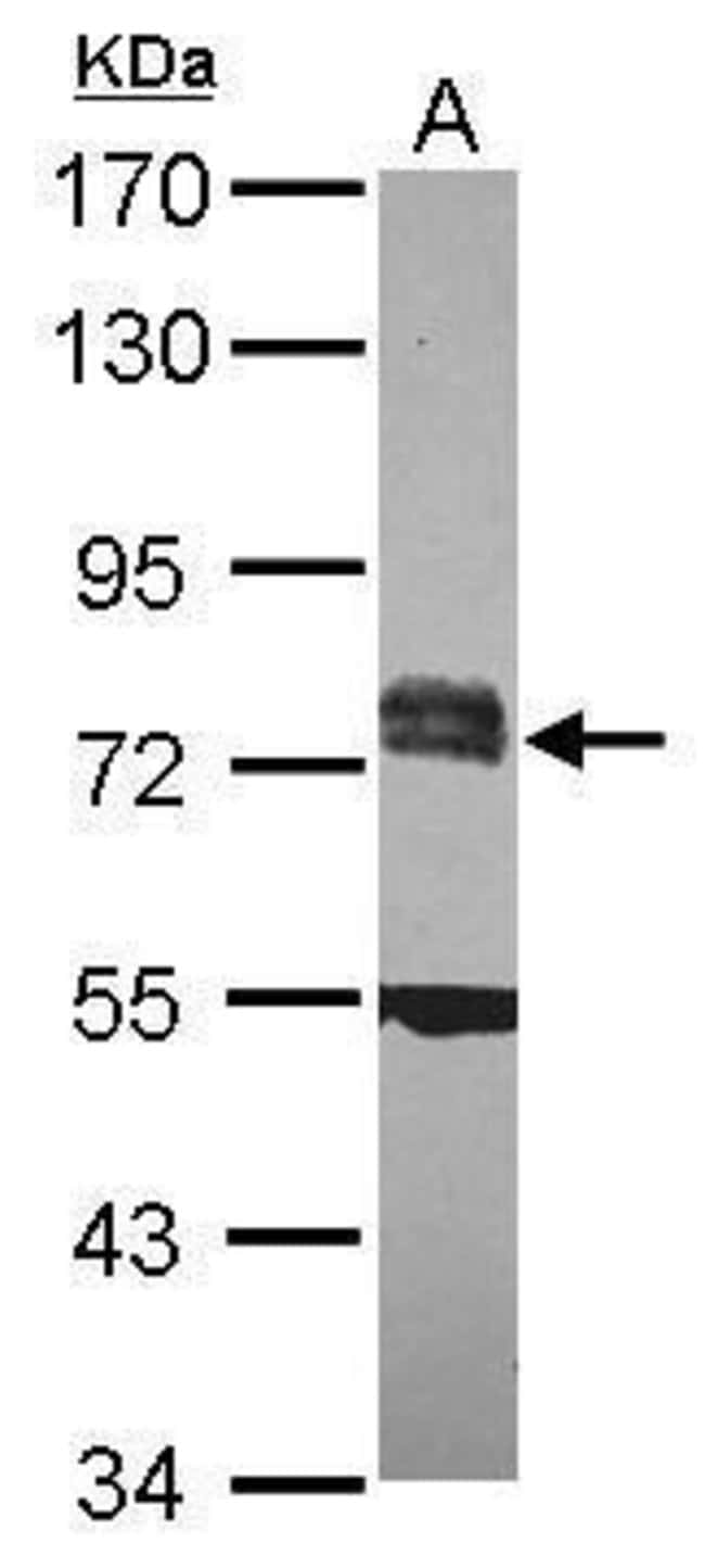Anti-RC74