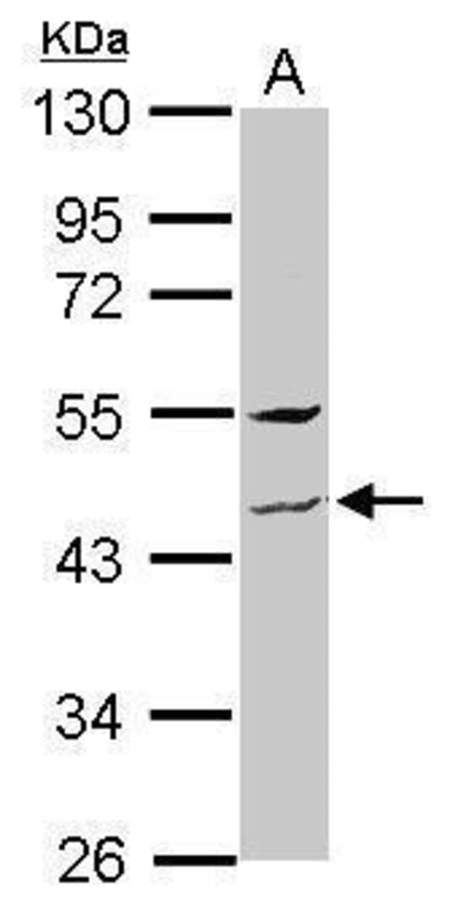 Anti-ZNF514