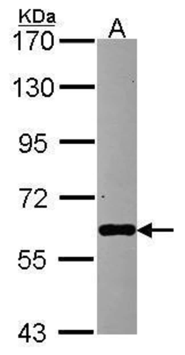 Anti-Mt PAP