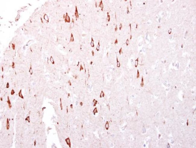 Anti-GTPBP3
