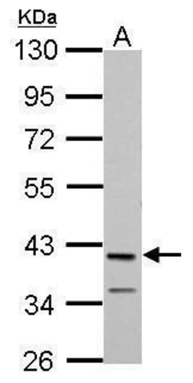 Anti-MAB21L1