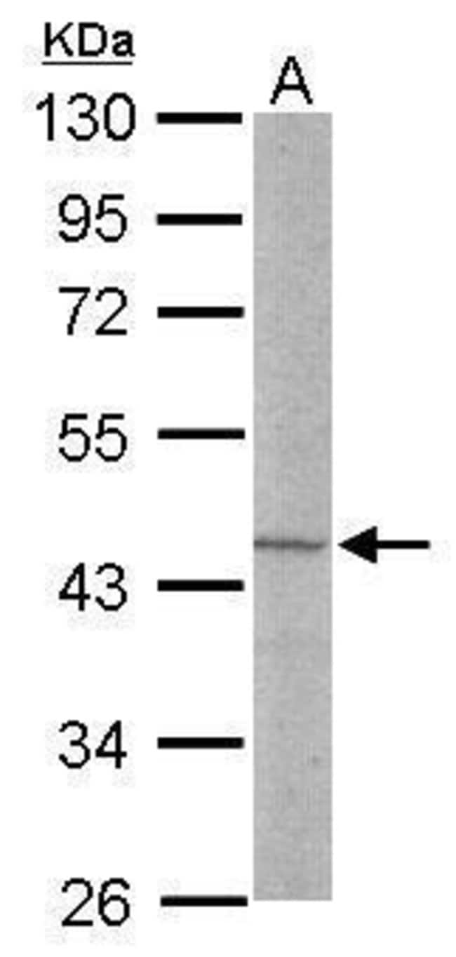 Anti-LDB2