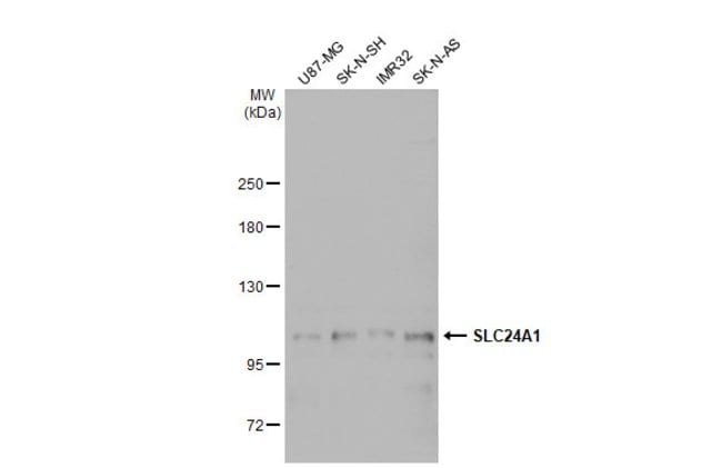 Anti-SLC24A1