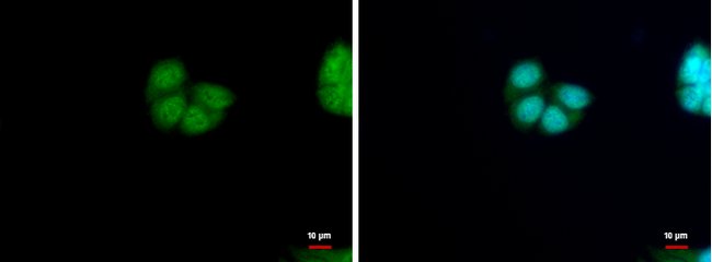 Anti-HRSP12