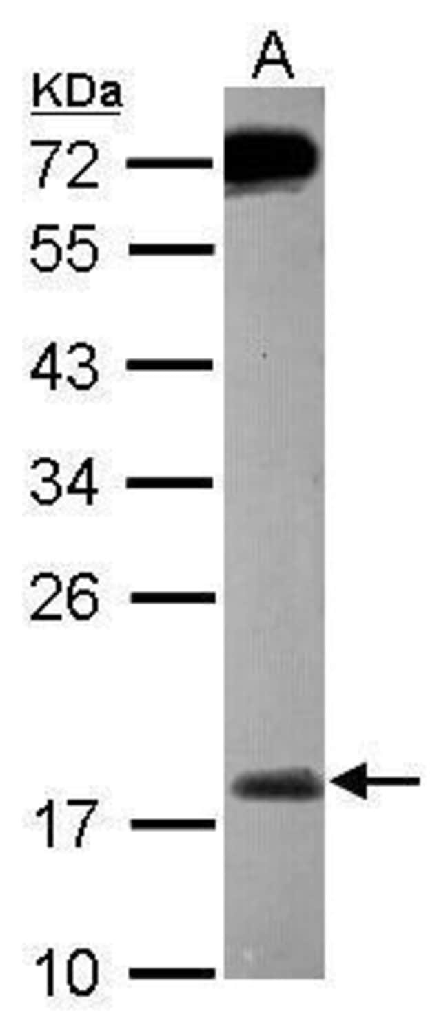 Anti-MSRB2
