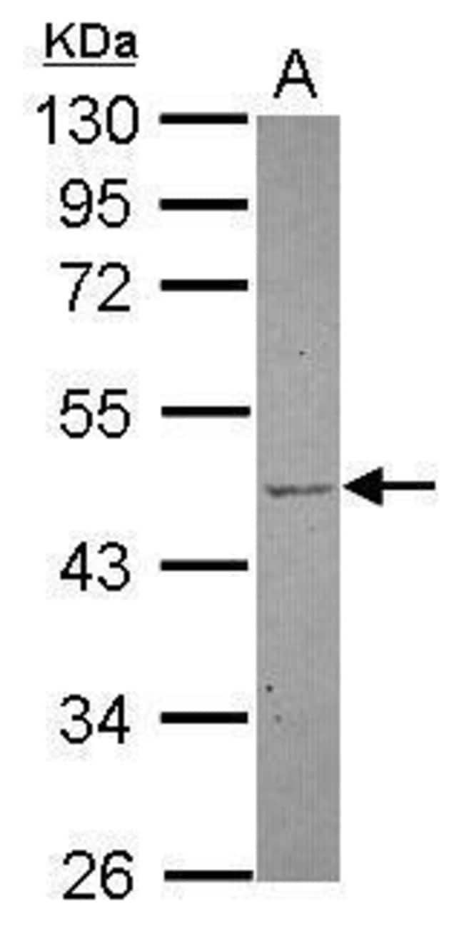 Anti-TBL2