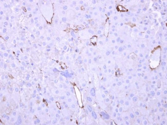 Anti-HECA