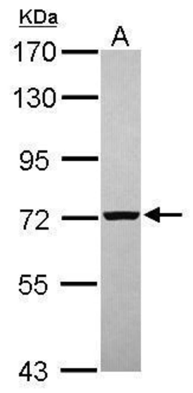 Anti-PGM2