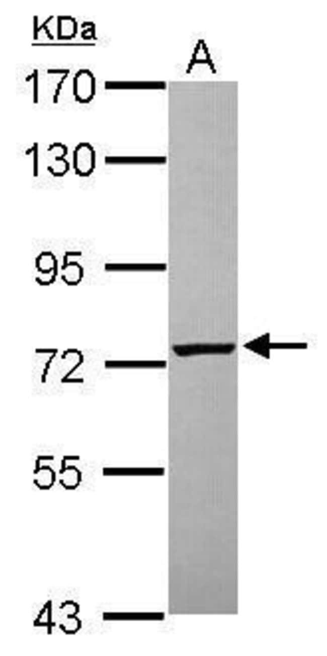 Anti-PGM2