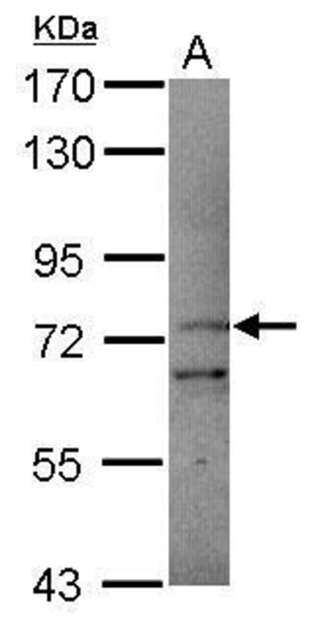 Anti-PCDHB11
