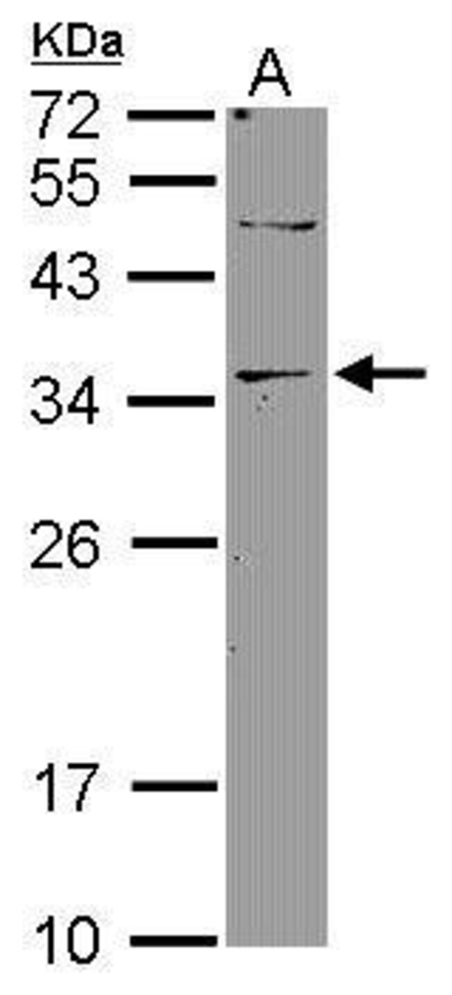 Anti-DNASE2B