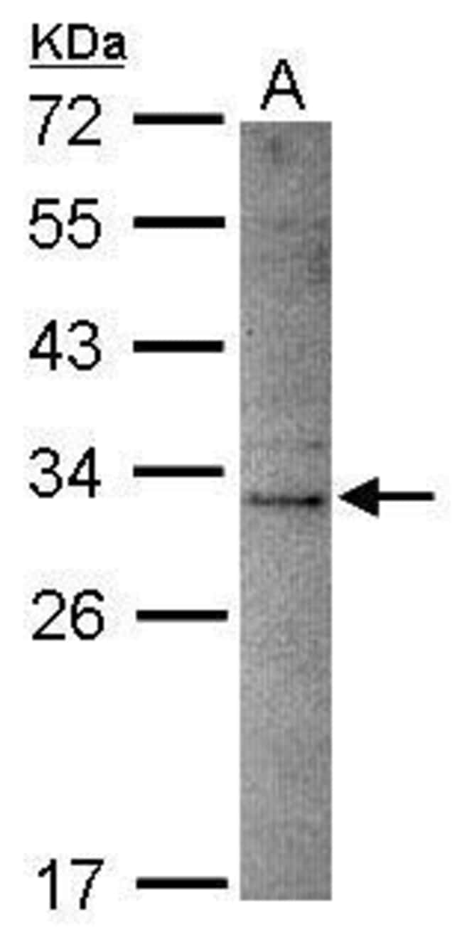 Anti-DNASE2B