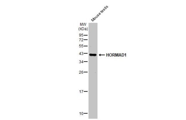 100uL Polyclonal antibody, HORMAD1, host