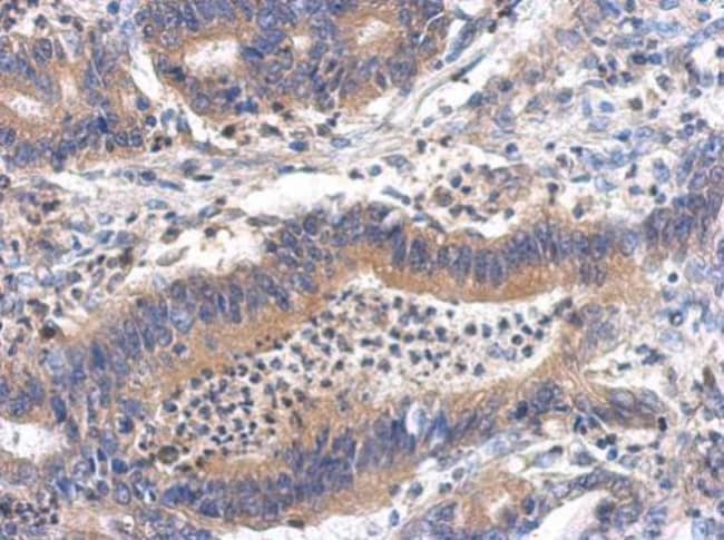 100uL Polyclonal antibody, GHDC, host ra