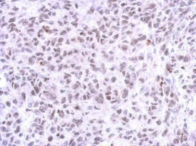 100uL Polyclonal antibody, ZNF587, host