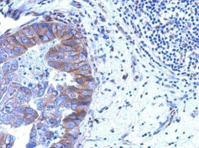 100uL Polyclonal antibody, ZNF598, host