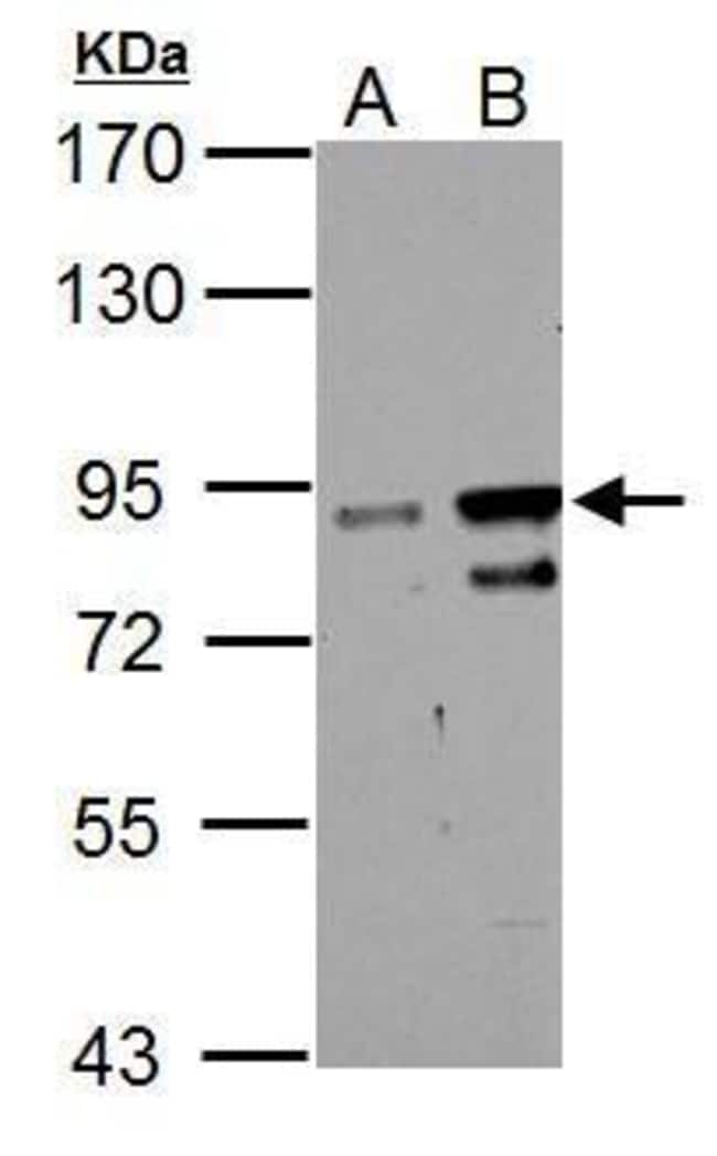 100uL Polyclonal antibody, ZNF598, host