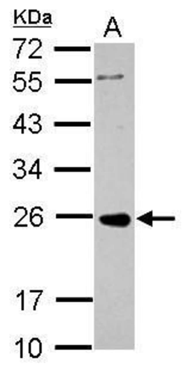 100uL Polyclonal antibody, PRKCDBP, host