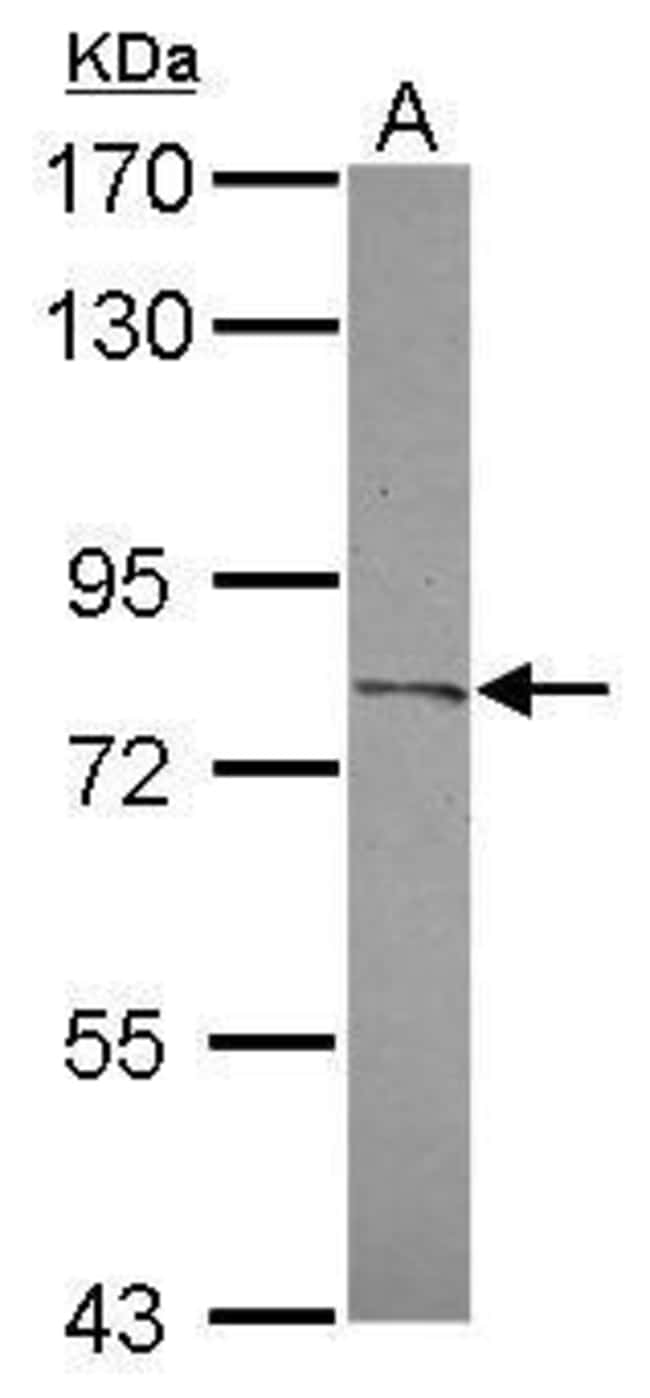 100uL Polyclonal antibody, CPXM2, host r