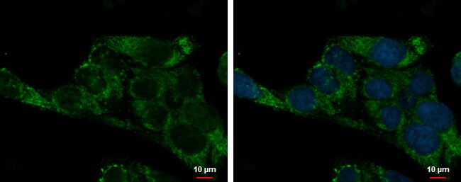 100uL Polyclonal antibody, ADHFE1, host