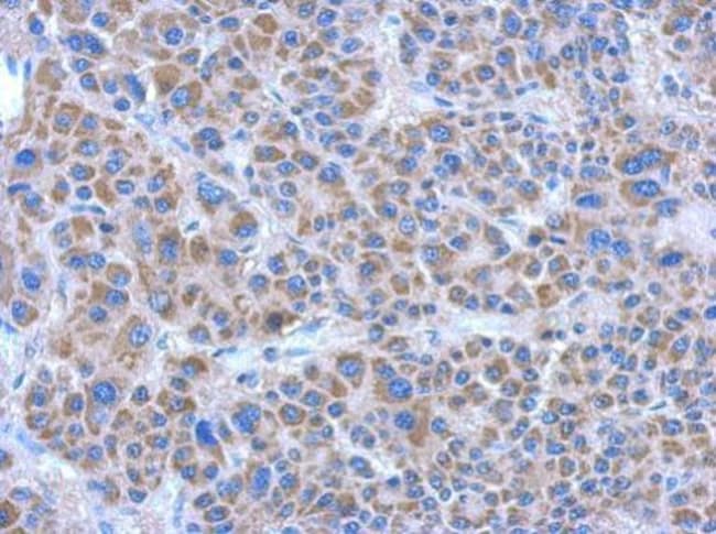 100uL Polyclonal antibody, ADHFE1, host