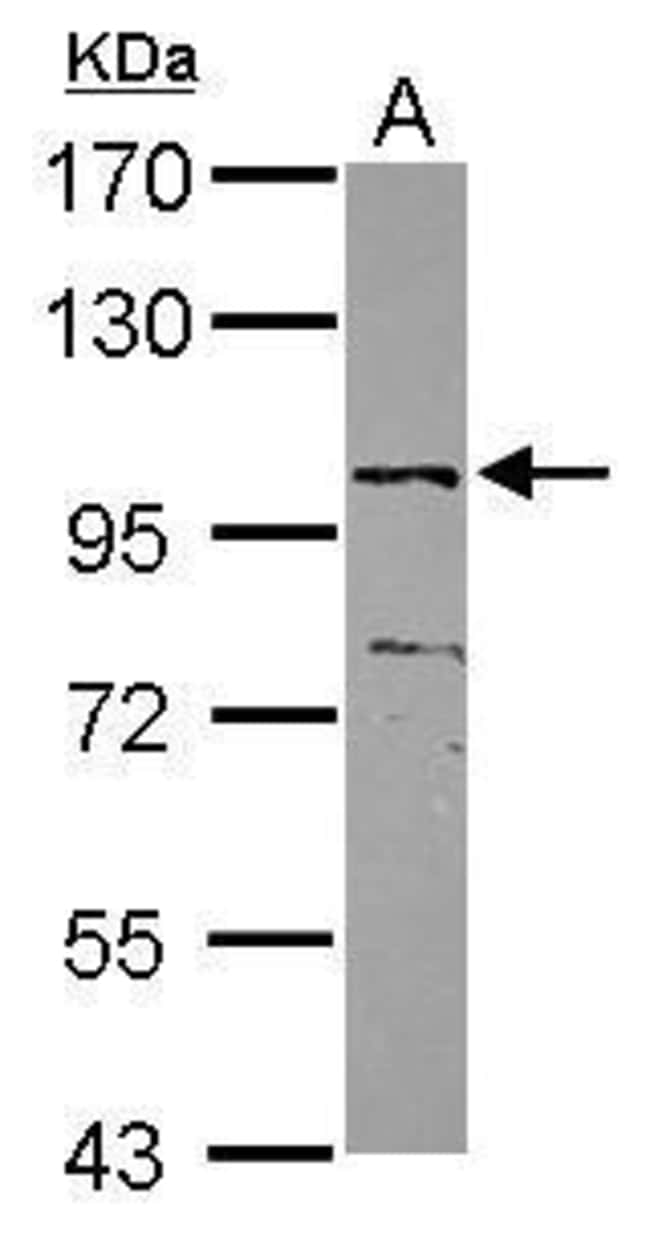 100uL Polyclonal antibody, ZNF690, host