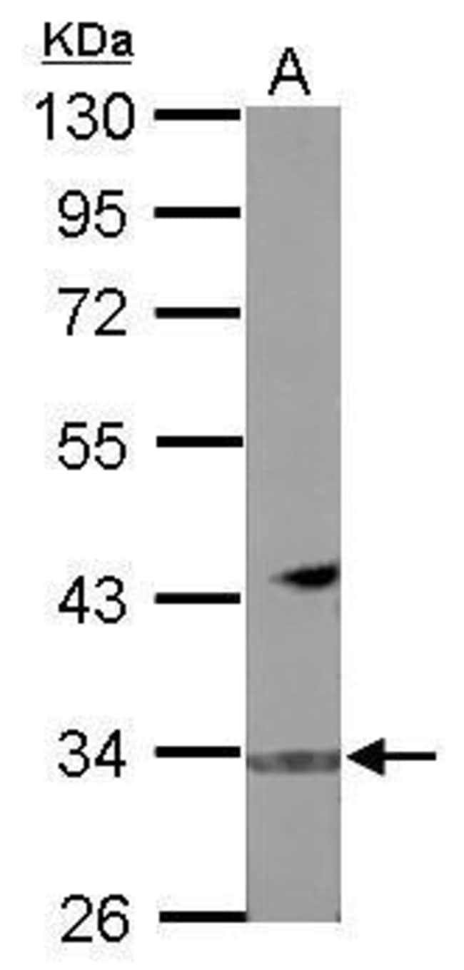 100uL Polyclonal antibody, FBXO16, host