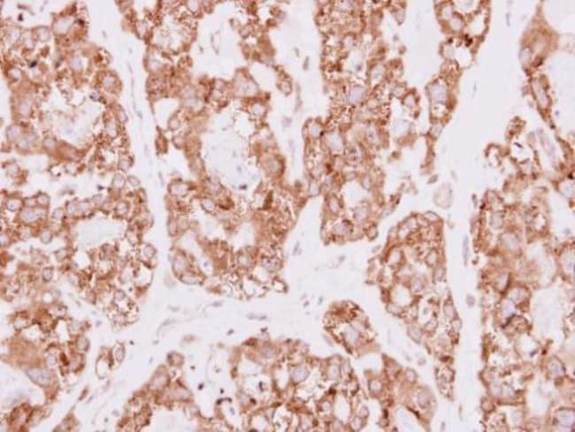 100uL Polyclonal antibody, SDR16C5, host