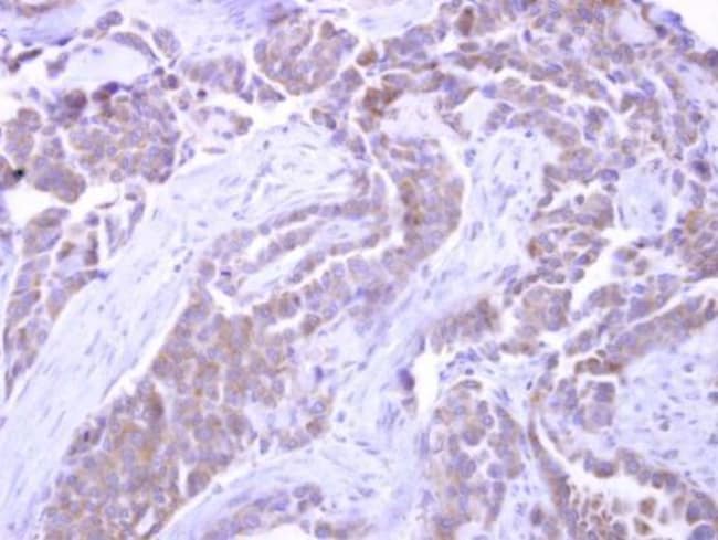 100uL Polyclonal antibody, SNX33, host r