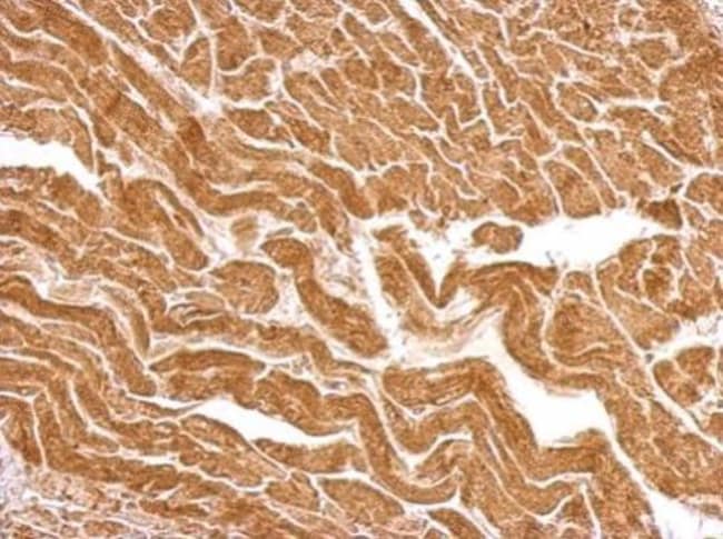 100uL Polyclonal antibody, UBE2O, host r