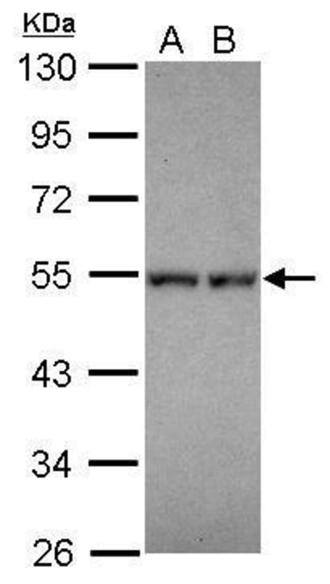 100uL Polyclonal antibody, DPF1, host ra
