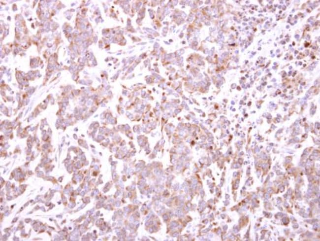 100uL Polyclonal antibody, triM49, host