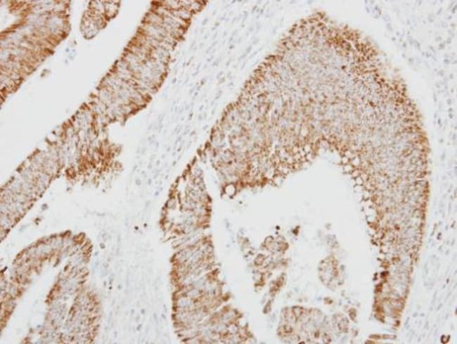 100uL Polyclonal antibody, kallistatin,