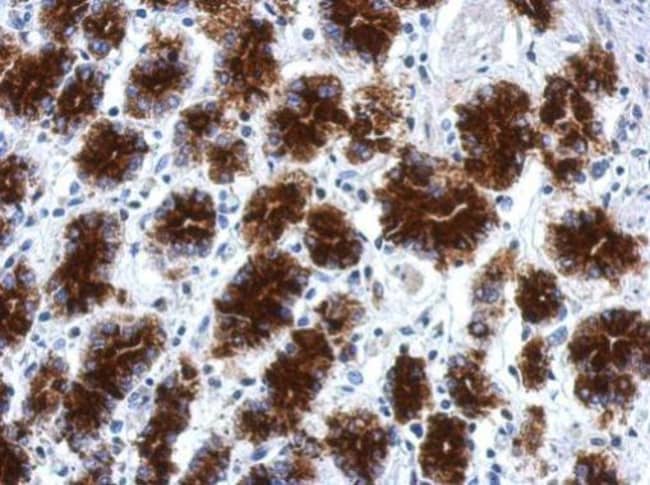 100uL Polyclonal antibody, CPXCR1, host