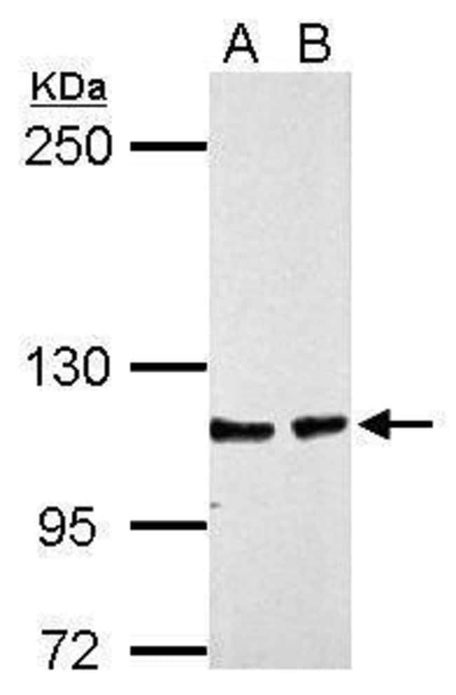 100uL Polyclonal antibody, CHD1L, host r
