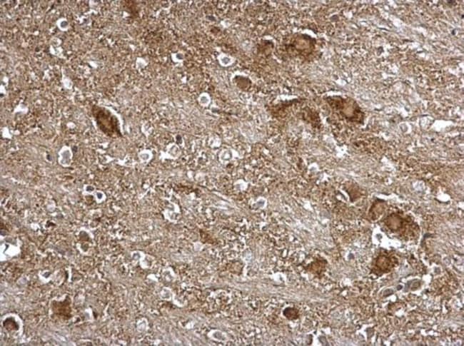 100uL Polyclonal antibody, ITM2B, host r