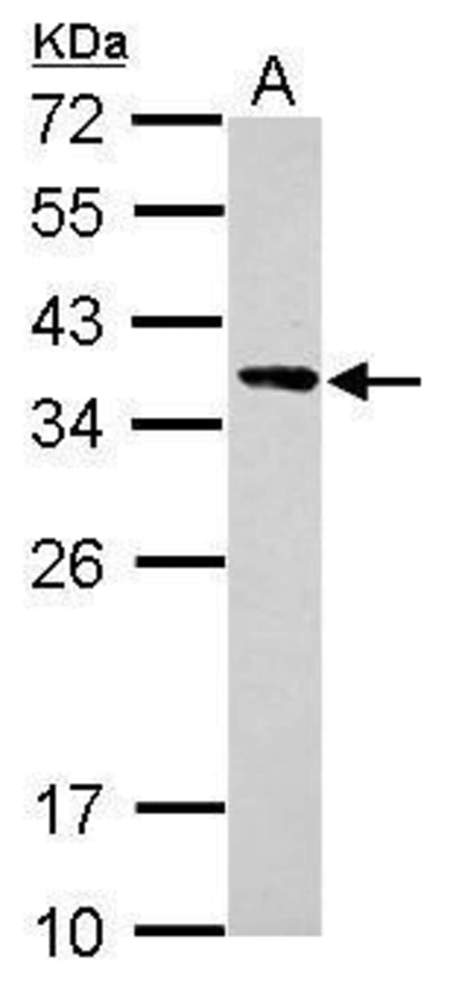 100uL Polyclonal antibody, calponin 2, h